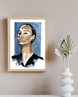 Lady Vitiligo - Print