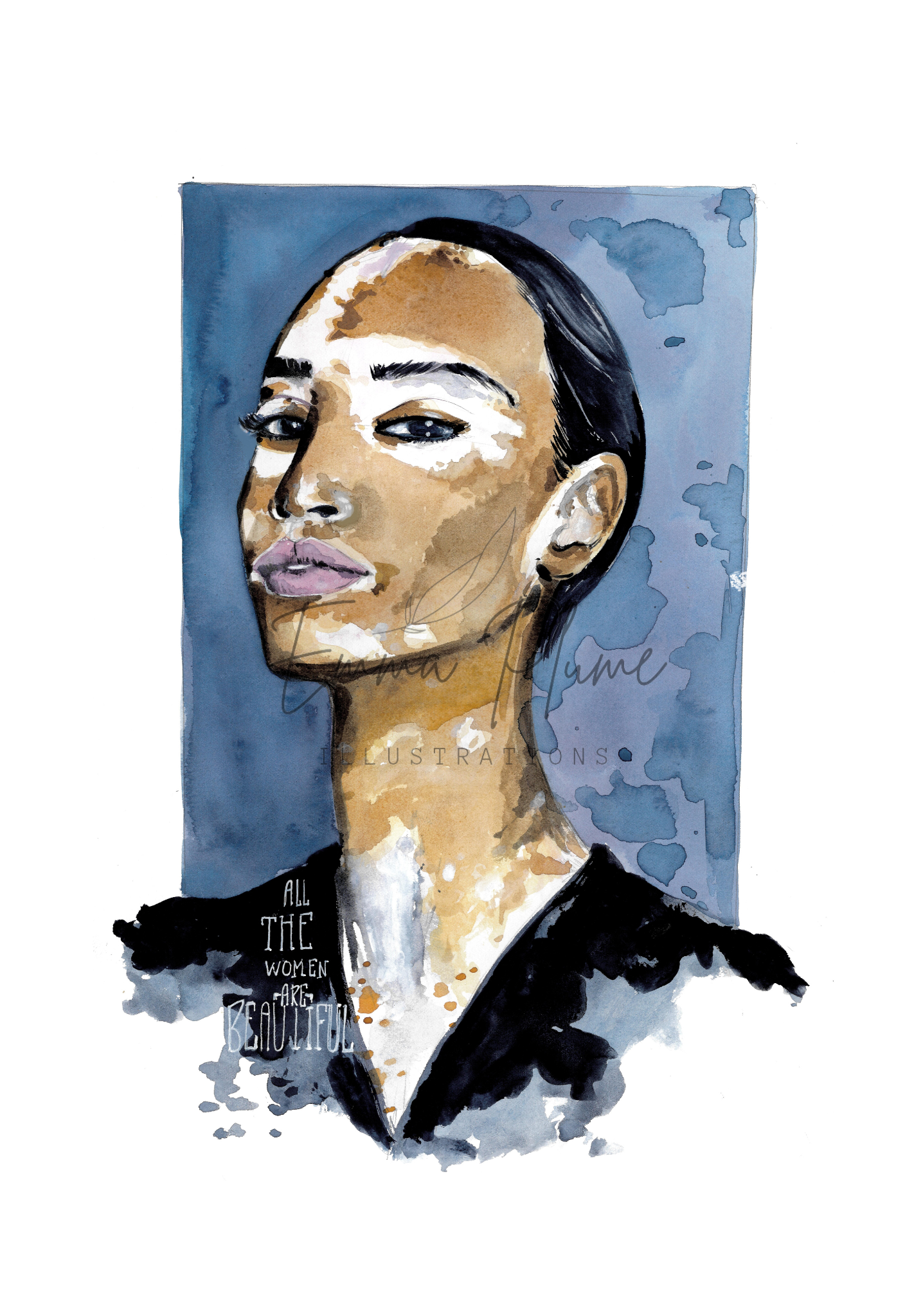 Lady Vitiligo - Print – Image 2